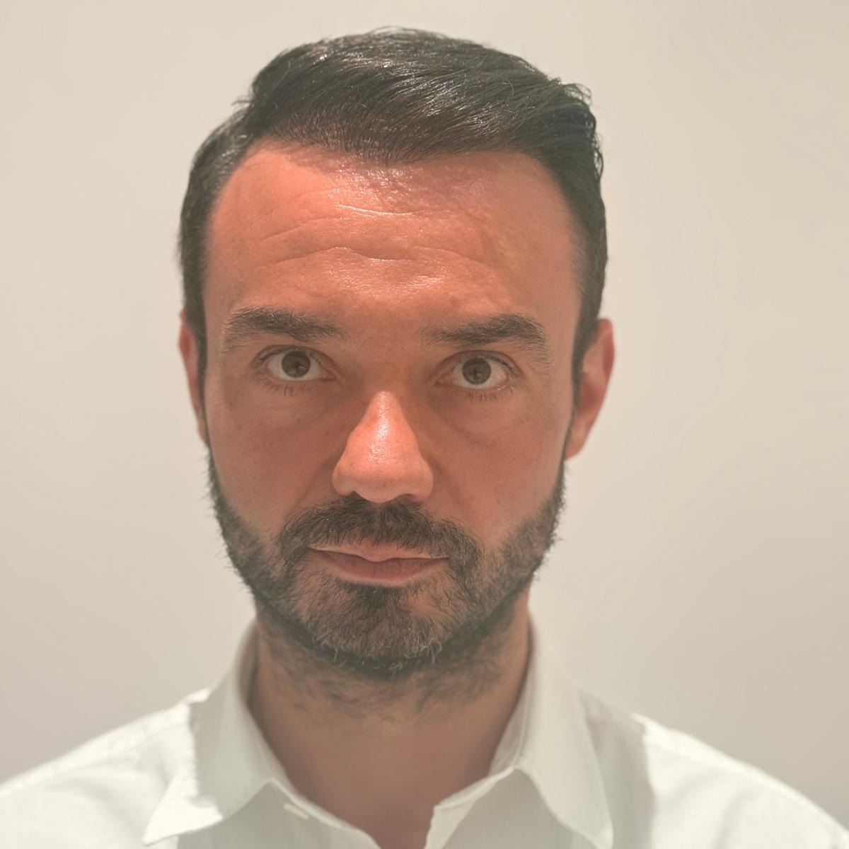 Hair restoration after treatment, frontal view